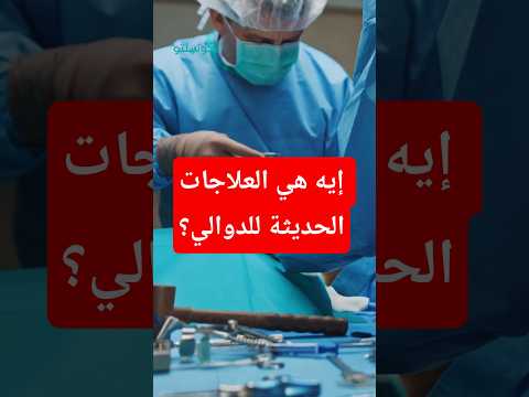 علاج الدوالي- طبيب يؤكد: هذه الطرق أفضل من الجراحة "فيديو" 