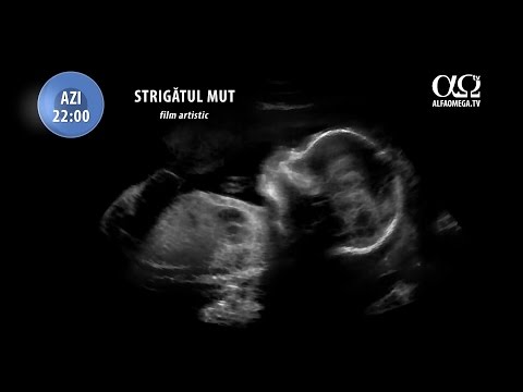 FILM: Strigătul mut - Miercuri, 29 martie 2017, ora 22, la Alfa Omega TV