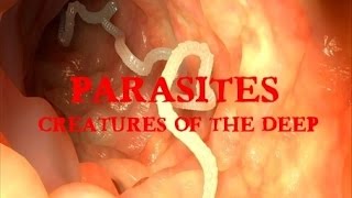 Parasites: Interterrestrial Reptillian Mind Controlling Entities