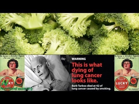 肺がんの転移とブロッコリー (Lung Cancer Metastases and Broccoli)