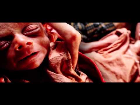 download lagu mp3 mp4 Food Wastage Helpline, download lagu Food Wastage Helpline gratis, unduh video klip Food Wastage Helpline