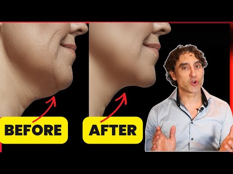 🎌 Exactly How To Get Rid of Your Double Chin For Good 🎌// A 2024 Update