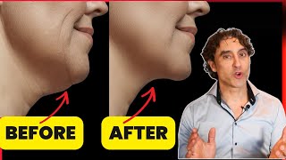 🎌 Exactly How To Get Rid of Your Double Chin For Good 🎌// A 2024 Update