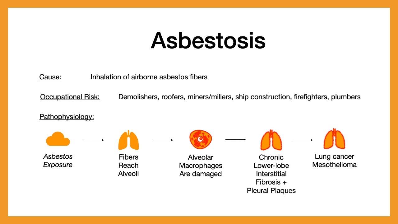 Occupational Lung Diseases