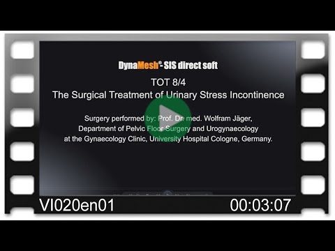 DynaMesh®-SIS direct soft - OR-Video: TOT 8/4 - Surgical Treatment of Urinary Stress Incontinence