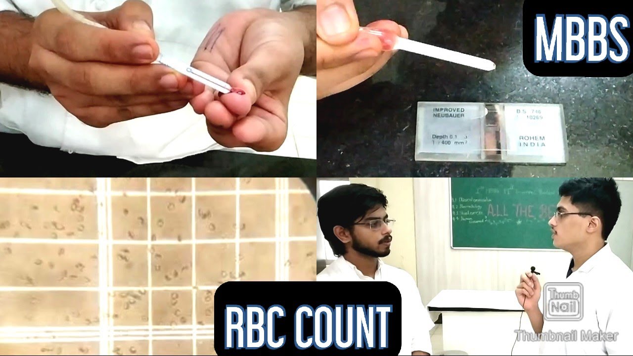 Watch video RED BLOOD CELL (RBC) COUNT, English/Hindi | MUHS | #mbbs #hematology Now RED BLOOD CELL (RBC) COUNT, English/Hindi | MUHS | #mbbs #hematology