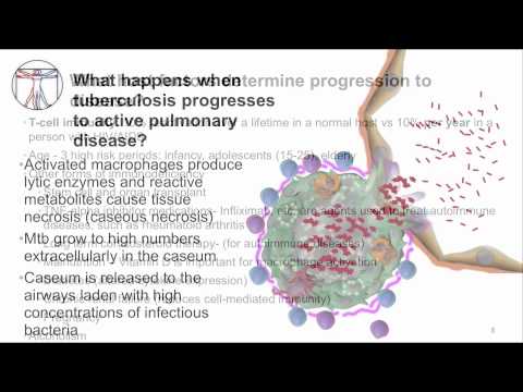 Tuberculosis: Infection & Disease Part 2