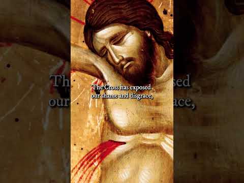 The Cross Has Exposed our Shame and Disgrace