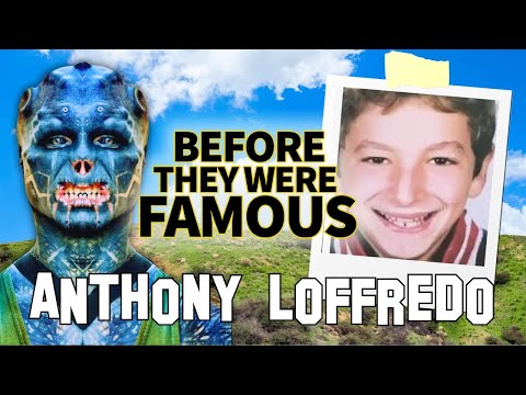 Anthony Loffredo Before