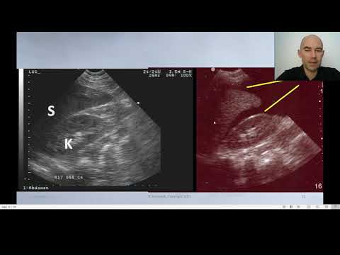 Seminarium V (Procedury ratunkowe) - USG eFAST (1/5)