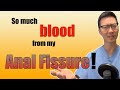 2 Reasons Why Your Anal Fissures Bleed So Much