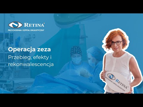 Operacja zeza – przebieg, efekty i rekonwalescencja