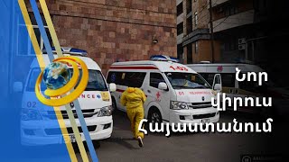 Հայաստանում շրջանառվում է նոր վիրուս, որը դեռ պաշտոնական անվանում չունի