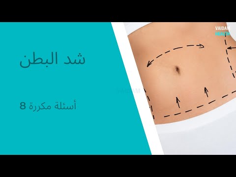 الأسئلة المتداولة حول عملية شد البطن.
