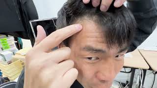 薄毛治療を始めて9ヶ月でかなり変化した髪の毛の話