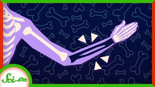 You're Losing Bones Right Now