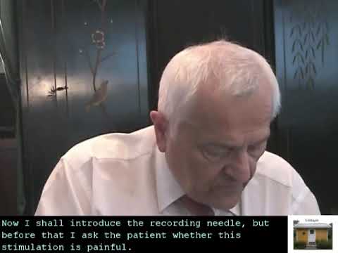 SFEMG - Stimulation Tib Ant  (Joze Trontelj)