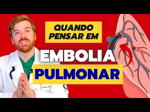 5 Sinais Comuns de EMBOLIA / TROMBOSE PULMONAR que você não pode ignorar!