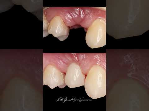Marco Squicciarini-14