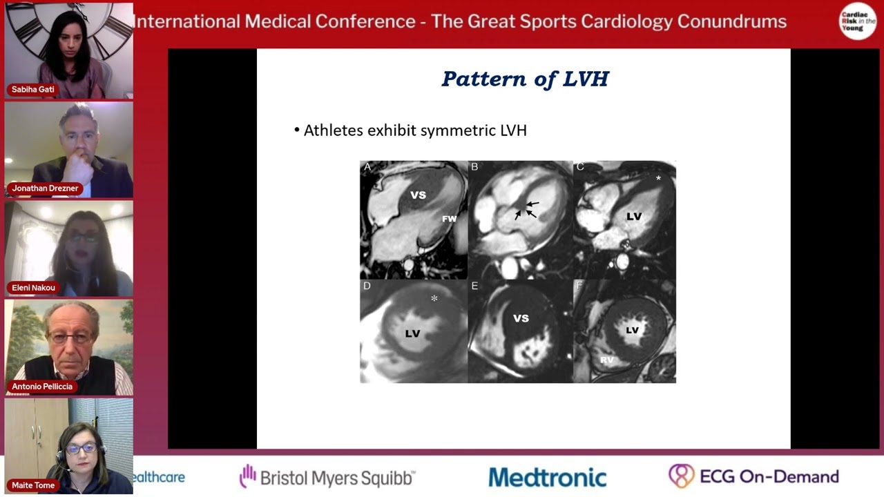 Athlete with left ventricular hypertrophy - Dr Eleni Nakou