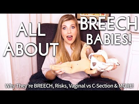 Breech Babies: Why They're Breech, Risks, Natural vs Cesarean & MORE! | Sarah Lavonne