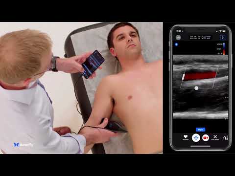 Performing Upper Extremity Vein Access