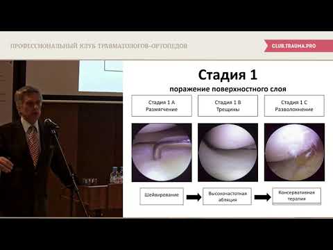 Врач по травме локтевого сустава и переломах Дурмана для остеохондроза