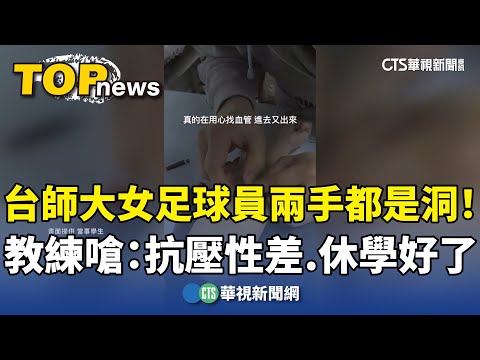 台師大女足球員兩手都是洞！　教練嗆：抗壓性差.休學好了