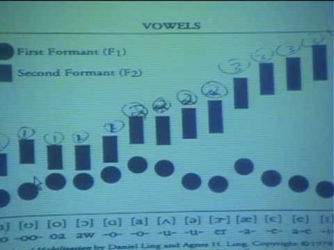 Importance of speech perception pre & post CI