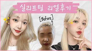 실리프팅 효과가 이정도라고?! 
