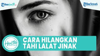 Banyak Tahi Lalat di Tubuh Dapat Dihilangkan secara Alami: Oleskan Bawang Putih hingga Sari Lemon