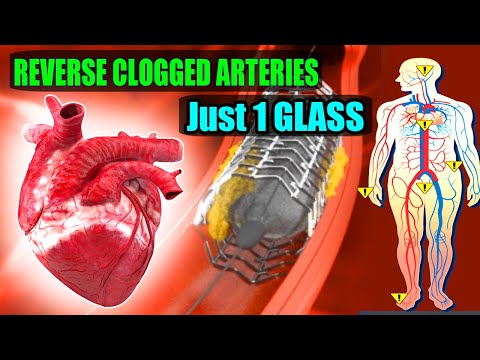 Just 1 GLASS OF THIS JUICE IN THE MORNING! REVERSE CLOGGED ARTERIES & LOWER HIGH BLOOD PRESSURE fast