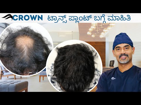 Hair Transplant In Bangalore | Best Clinic Surgeon...
