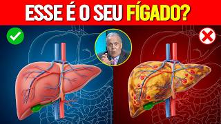 DR LAIR ALERTA: O inimigo MORTAL do se FÍGADO