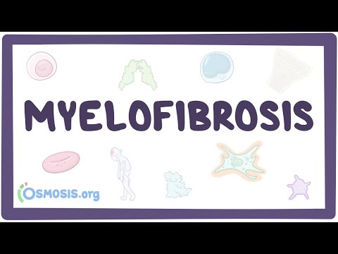 Myelofibrosis - causes, symptoms, diagnosis, treatment, pathology