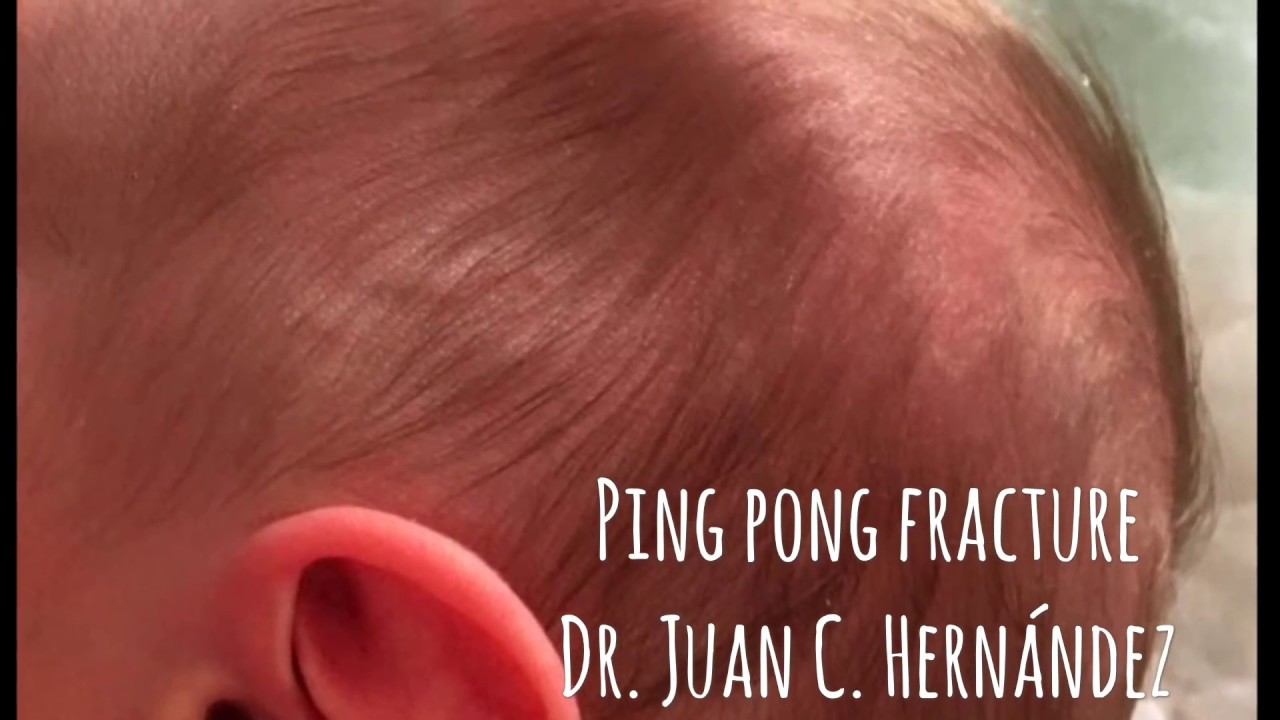 Juan Camilo Hernandez Acevedo-68