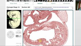Intro a virtual embryo