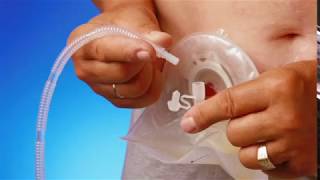 How to connect a urostomy pouch to night drainage bag