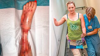 Girl Loses Limbs To Flesh-Eating Bacteria