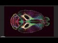 Brain Images Just Got 64 Million Times Sharper