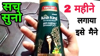 Kesh King Shampoo Results Kesh King Shampoo Review 2020 In Hindi | Kesh King Shampoo Review & Result