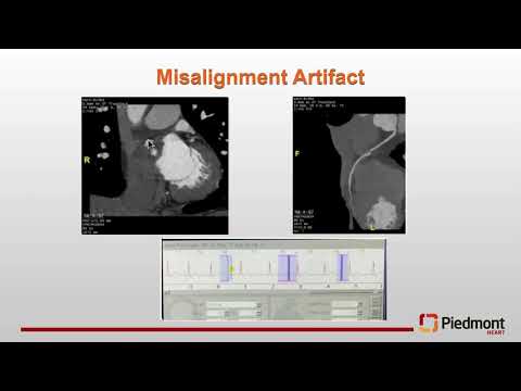 Sponsored webinar| CTA image acquisition & interpretation for transcatheter mitral & tricuspid valve