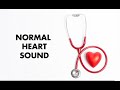 Normal Heart Sounds MEDZCOOL