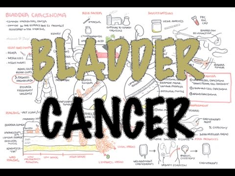 Bladder Cancer - Overview (types, pathophysiology, diagnosis, treatment)