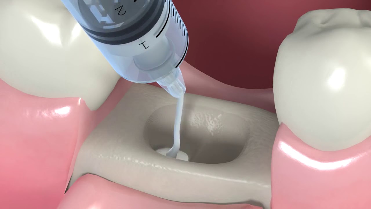 Pablo Gutiérrez López-10