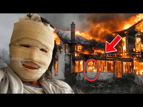 Single mother suffers burns to 60% of her body after running into burning home to save her children