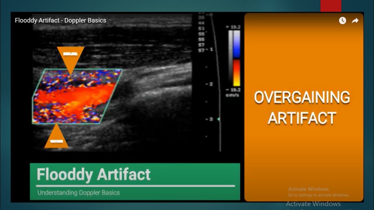 Flooddy Artifact - Doppler Basics