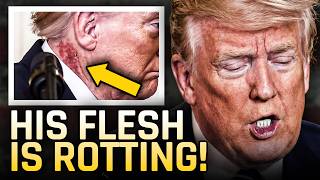 Trump Appears With Visibly Rotting Flesh During Speech