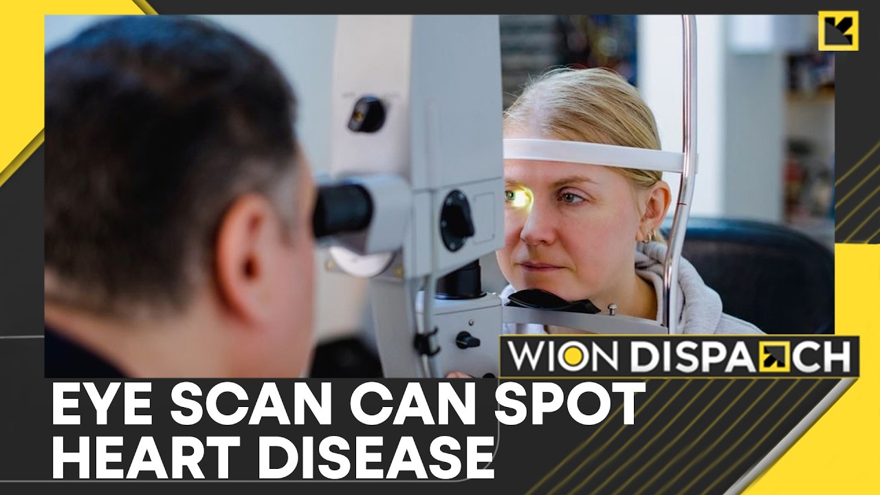 Study Shows Retinal Changes May Predict Atrial Fibrillation Early | WION Dispatch