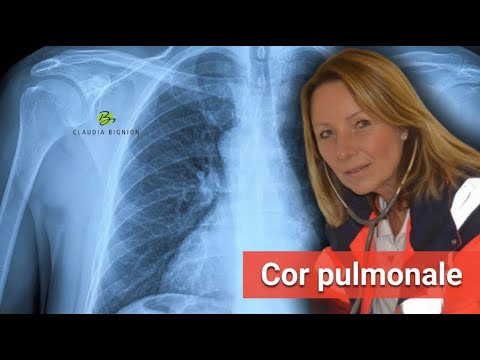 Pulmonary pulmonary disease: 6 causes you need to know | Dr. Claudia Bignion